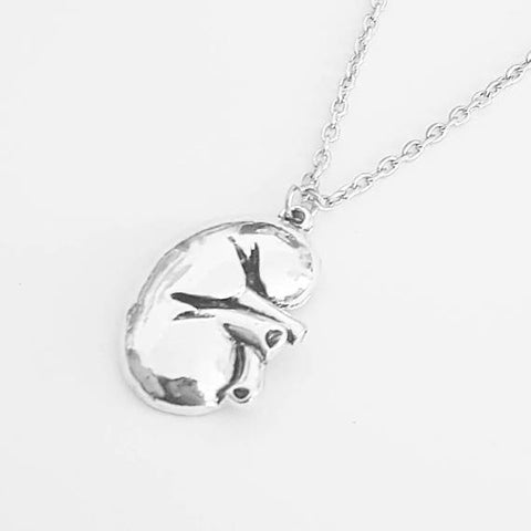 Kidney Anatomical Jewellery